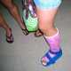 Ashleys hübscher pink-farbener Gips
